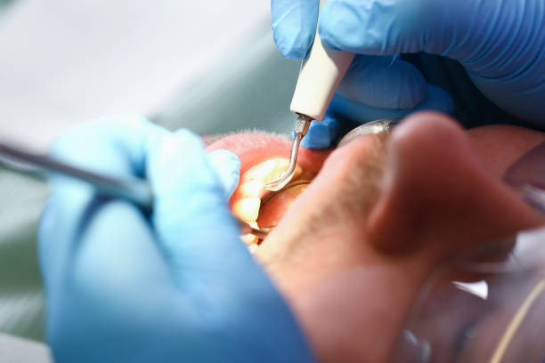 Best Emergency Treatment for Oral Infections in Mcdonough, GA