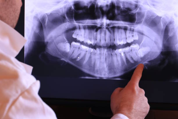 Best Broken or Chipped Tooth Repair in Mcdonough, GA
