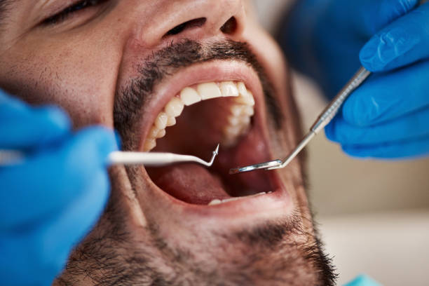 Best Emergency Care for Gum Disease in Mcdonough, GA